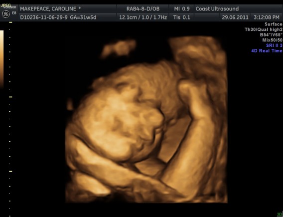 Little baby makepeace 3d ultrasound